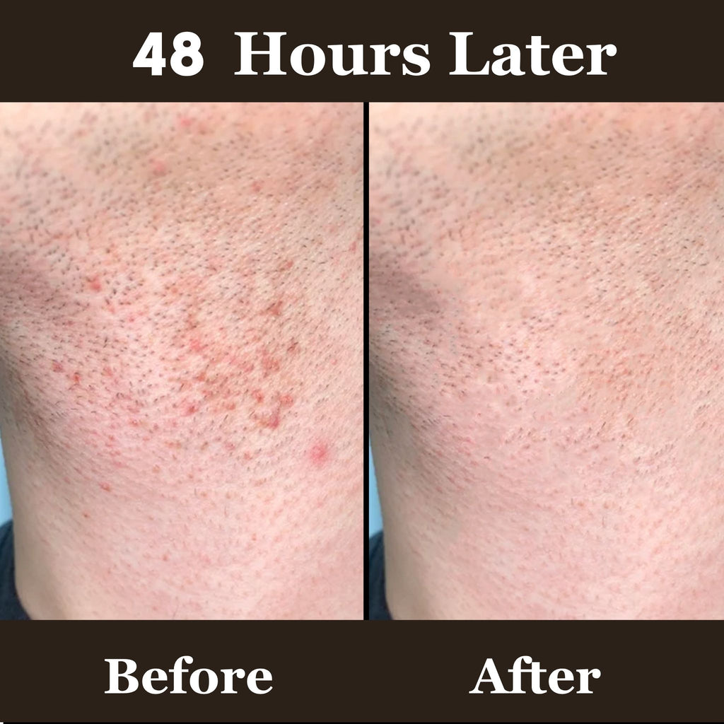 Before and after comparison of skin texture on the skin after shaving after 48 hours of use.
