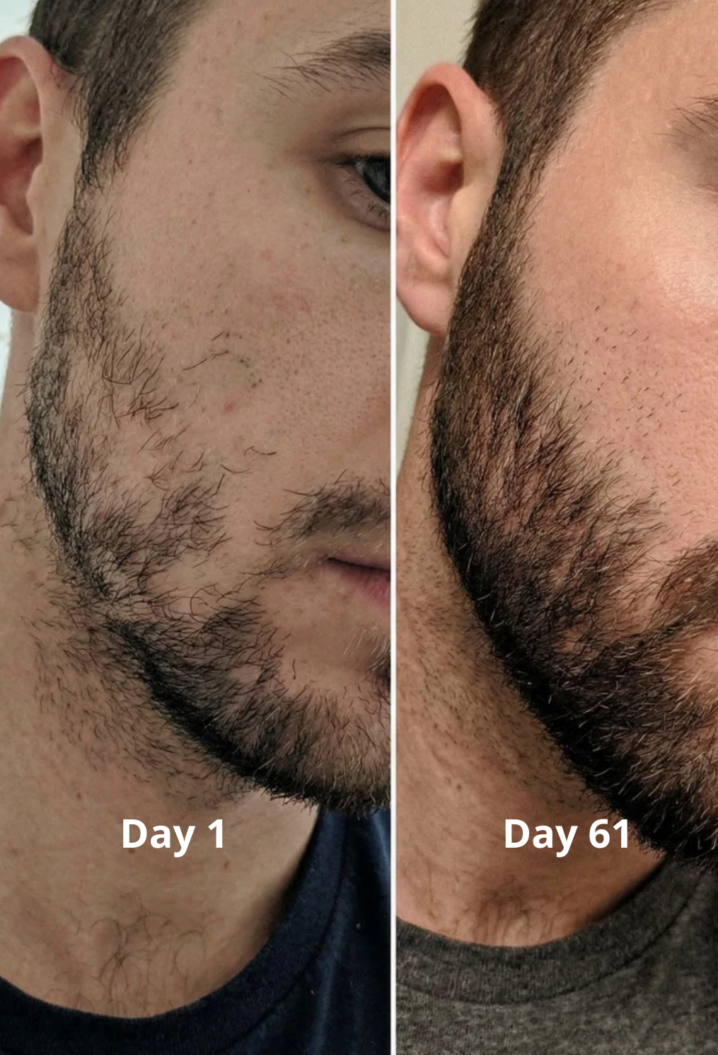 Buddy Beard Growth Oil 1 oz (30 ml)